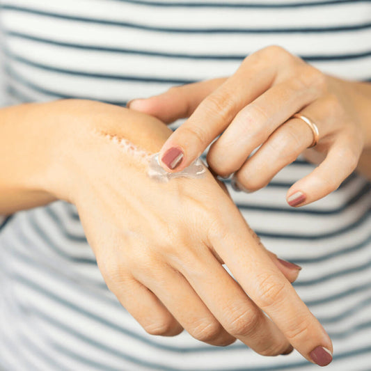 OrgPure Organic Scar Removing Gel. Shop Skin Care on Mounteen. Worldwide shipping available.